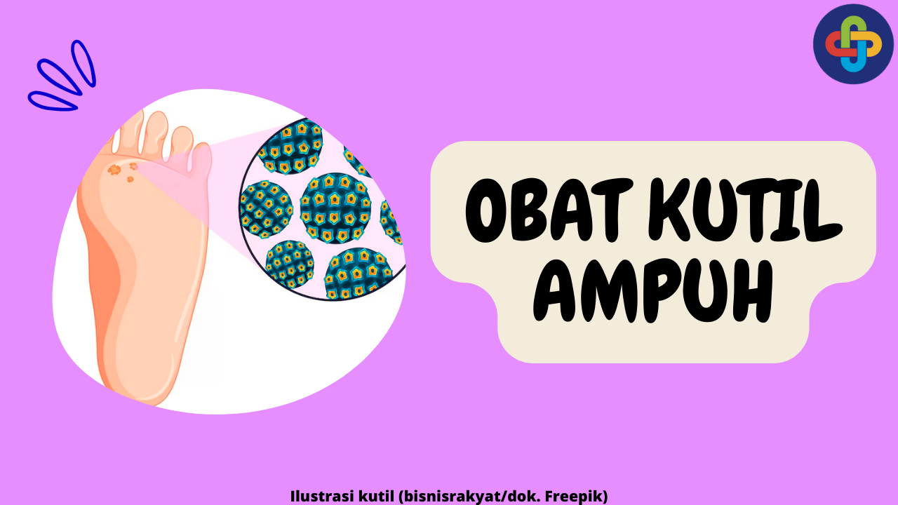 9 Pilihan Obat Kutil yang Terbukti Ampuh untuk Menyembuhkan